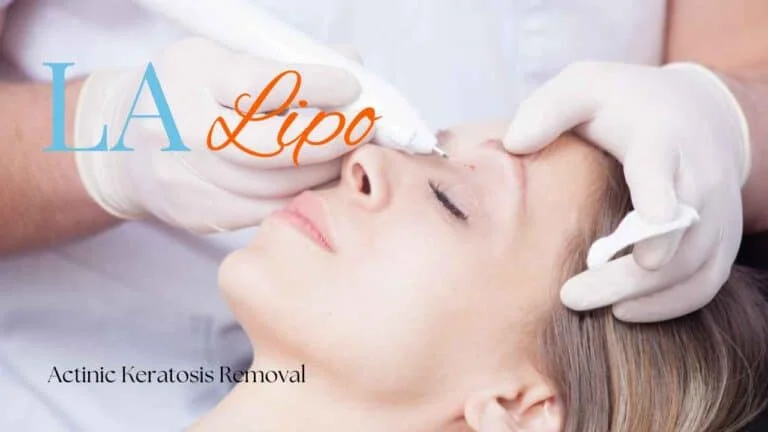 Woman receiving Actinic Keratosis Removal Treatment St John's Wood