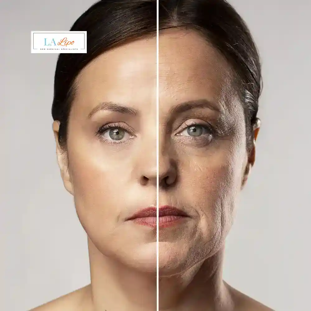How Can You Tell If Non-Surgical Skin Tightening Is Right for You St John's Wood?