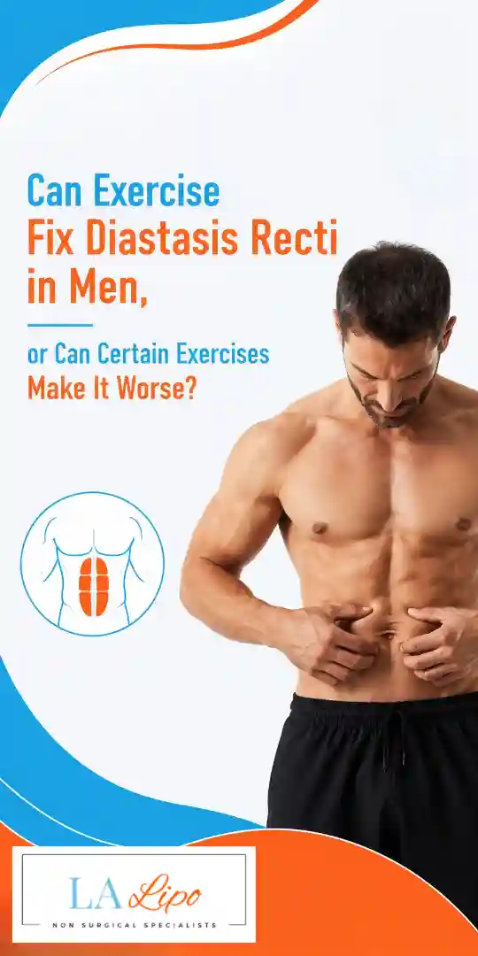 Can Exercise Fix Diastasis Recti in Men, or Can Certain Exercises Make It Worse St John's Wood?