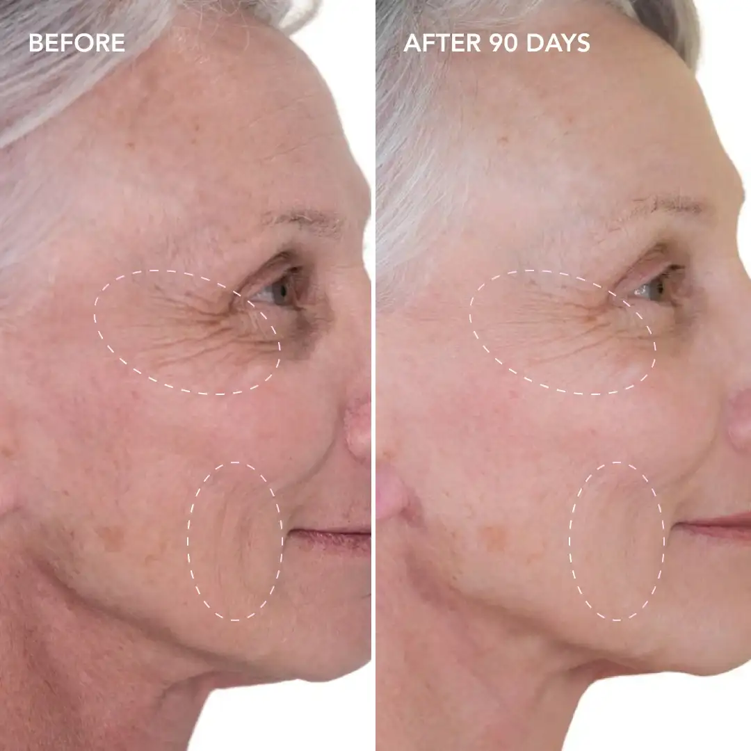 When will you see results St John's Wood